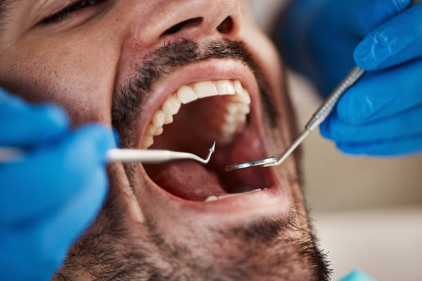 Oral Surgery in Pleasant Hill, PA